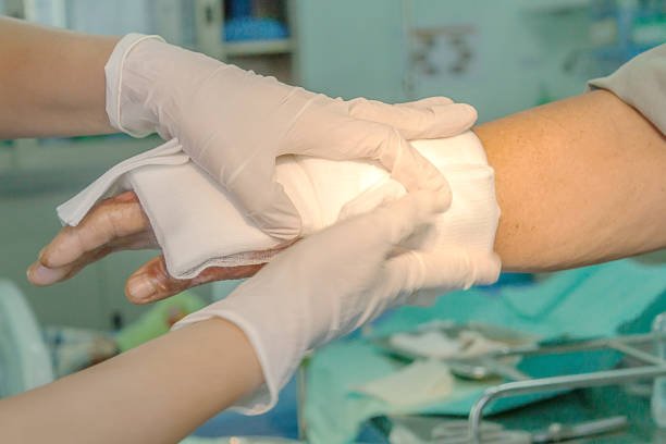 burn injury lawyer