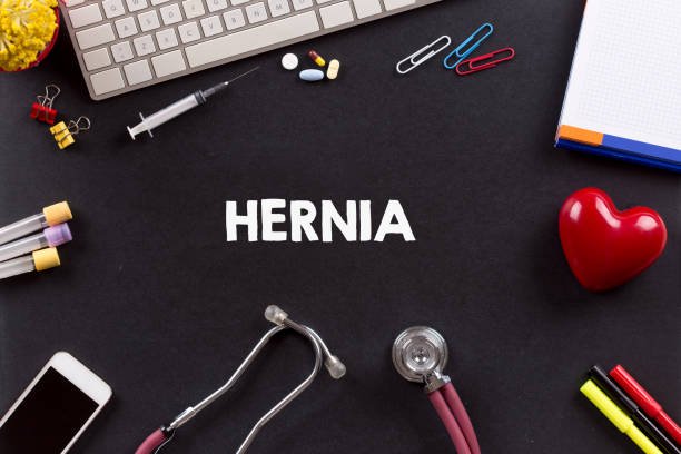 Hernia Mesh Lawsuits