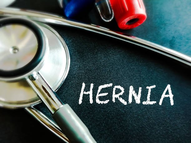 hernia mesh lawsuit compensation