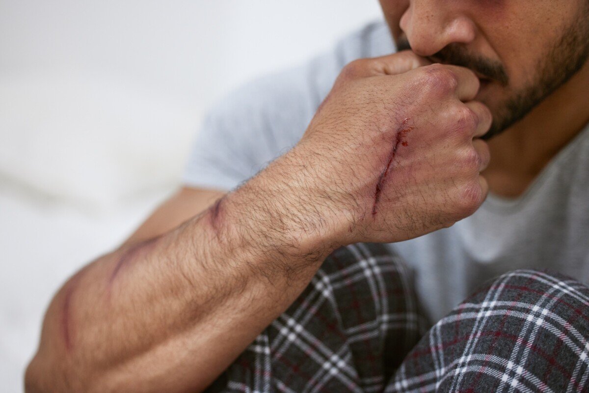 Irvine personal injury lawyer