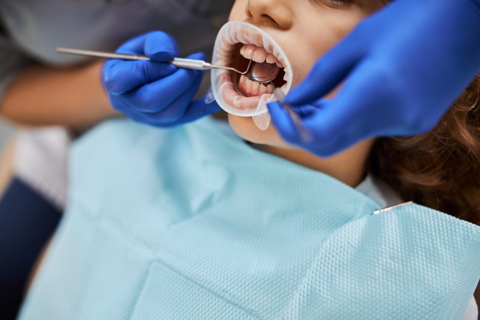 Medicare vs. Medicaid Dental Coverage
