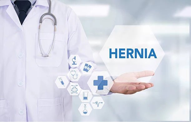 best lawyer for hernia mesh lawsuit