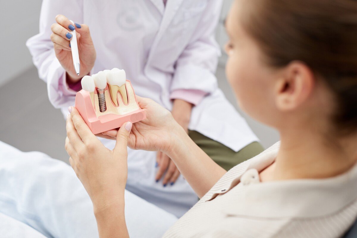3 tooth implant bridge cost