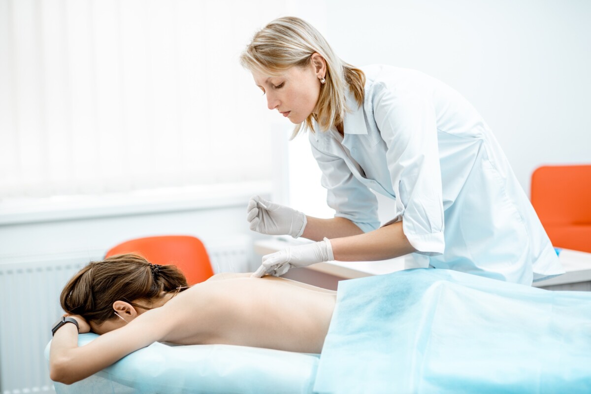 Is Acupuncture Covered by Insurance? Understanding Your Benefits and Options
