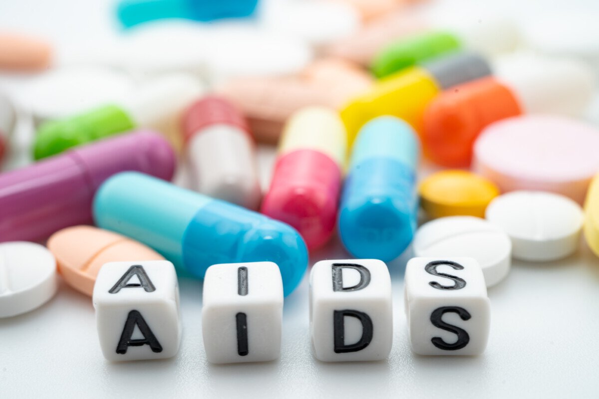aids symptoms women