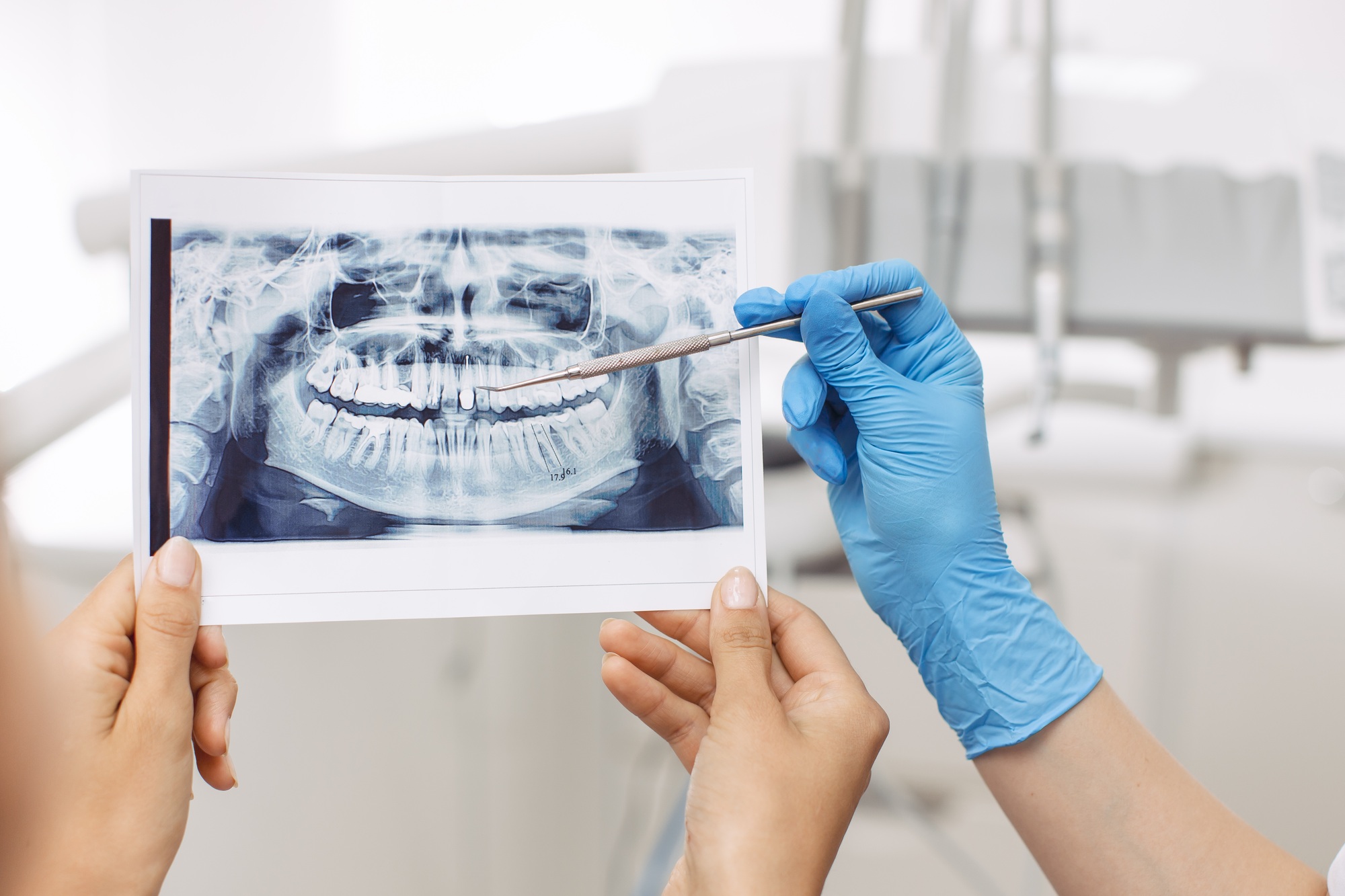 Anthem Medicaid KY Dental Coverage: Affordable and Reliable Dental Care for Kentuckians