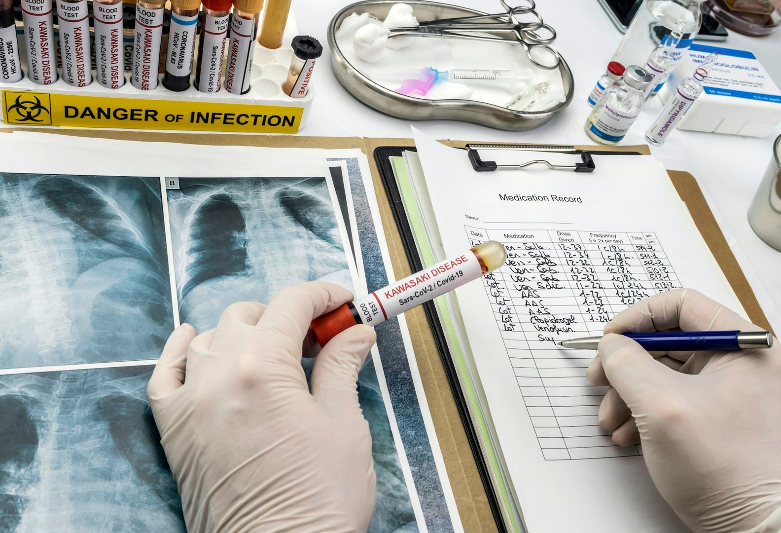 Chronic Obstructive Pulmonary Disease Screening