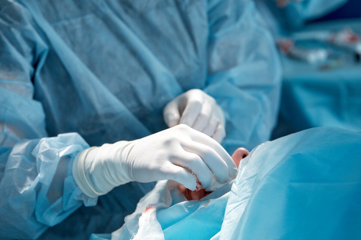 cuts to medicare