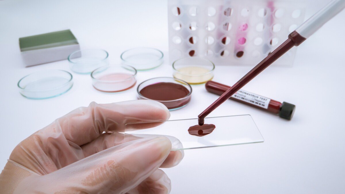 Does Medicare cover blood work?