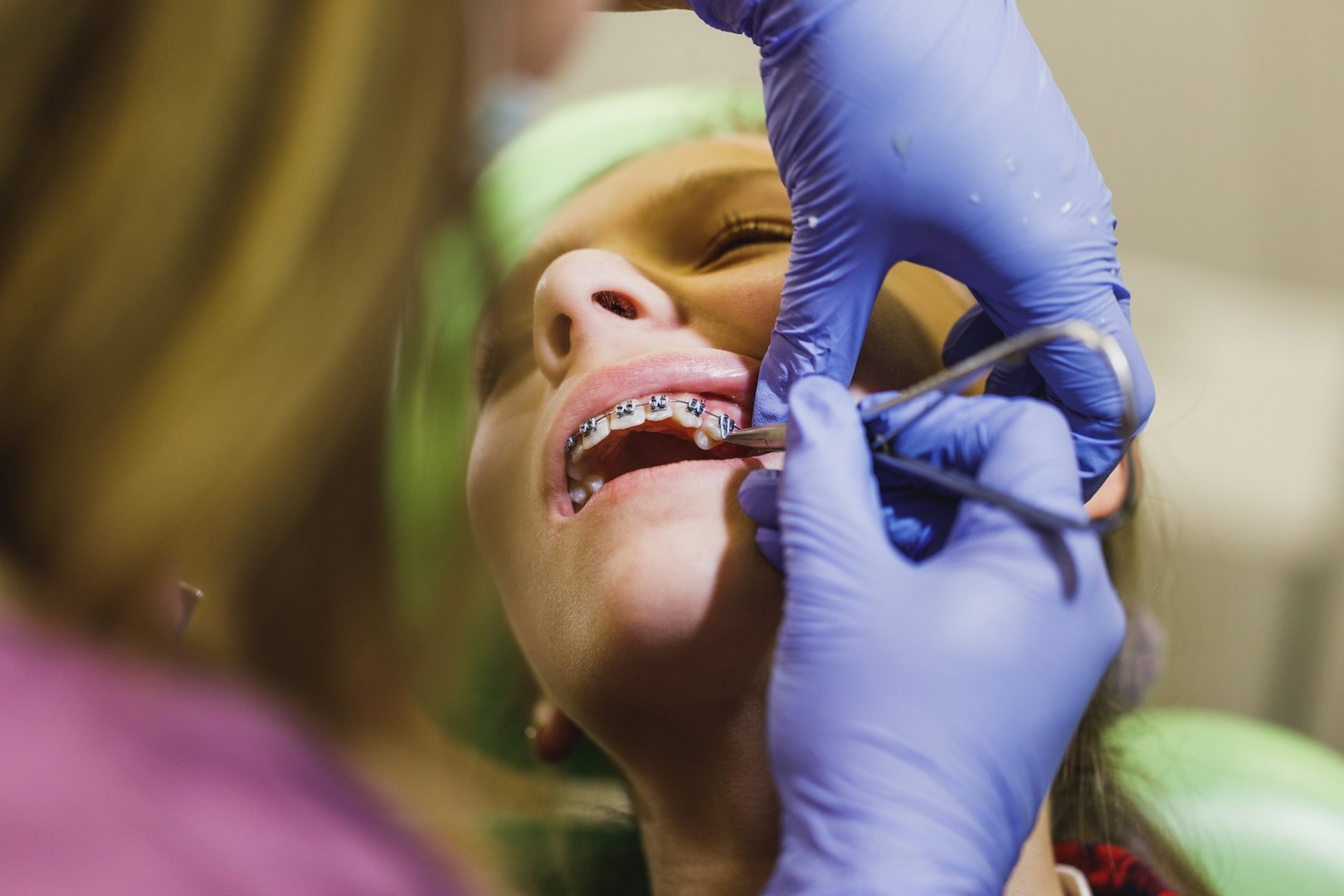 Orthodontic Coverage