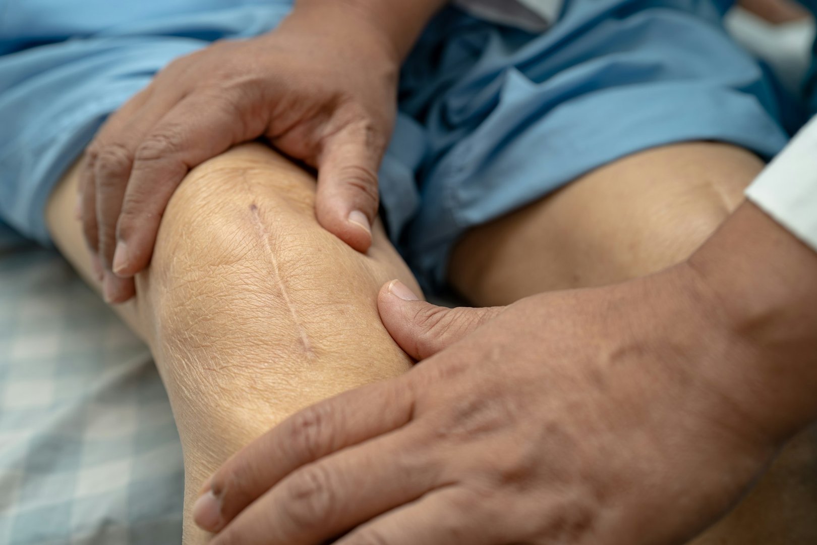Does Medicare Cover Knee Replacement