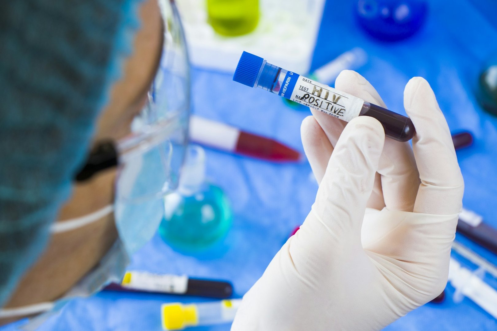 HIV Screening