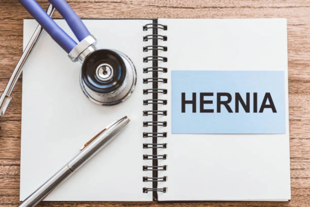 hernia mesh lawsuit lawyer