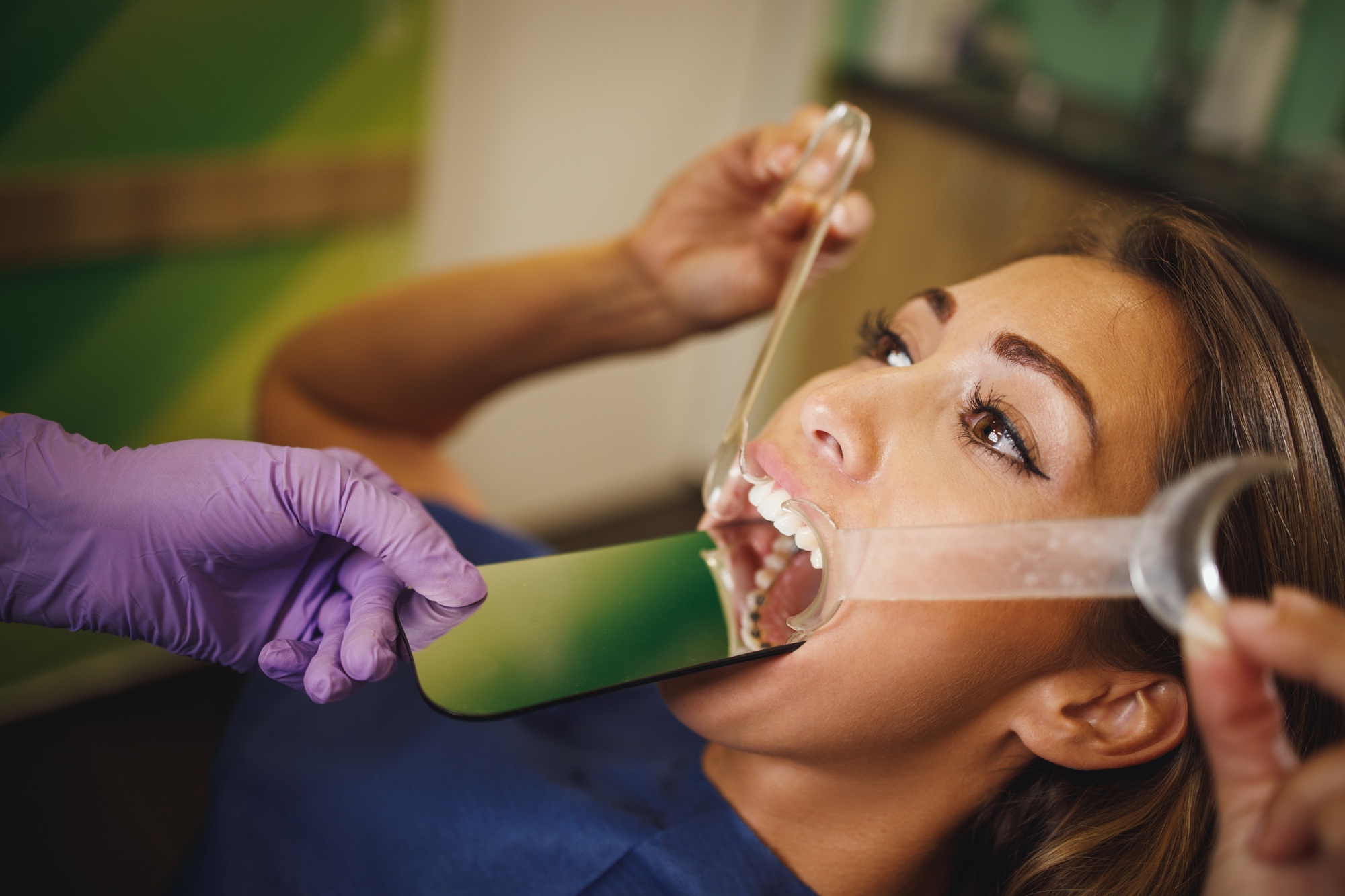 How to Get Braces Covered by Medical Insurance: A Comprehensive Guide