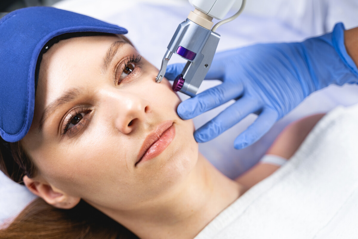 Achieve Radiant Skin with Kaiser Dermatology Microneedling Treatment