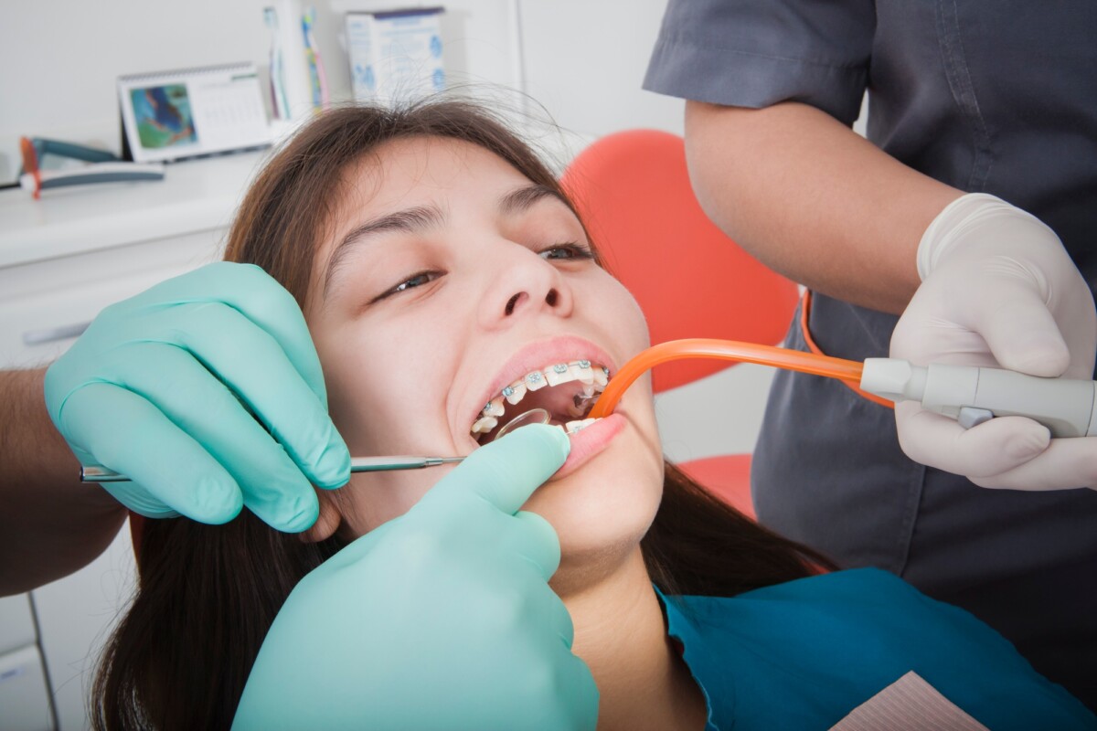 Marketplace Dental Insurance: Is It Worth It? Here’s the Truth