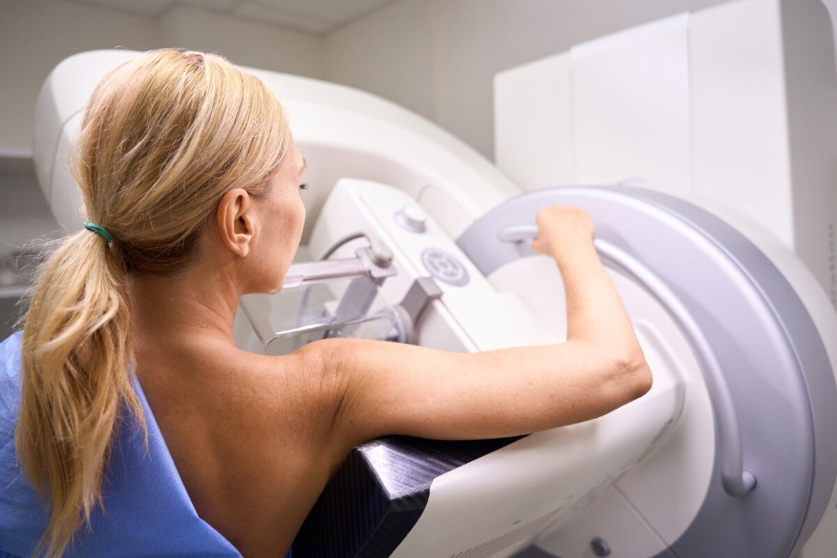 does medicare cover 3d mammograms