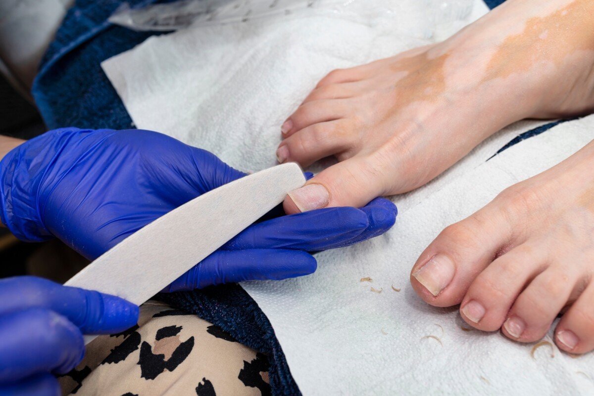 does medicare cover toenail clipping for seniors