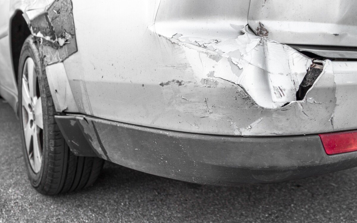 motor vehicle accident brain injury