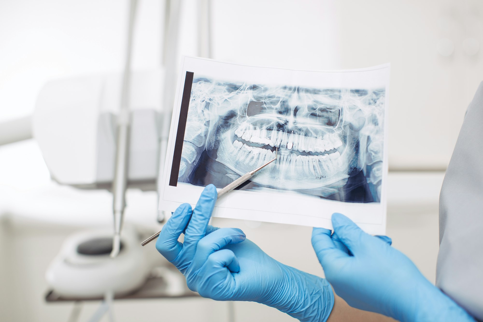 NY Medicaid Dental Coverage: Your Guide to Affordable Dental Care Plans