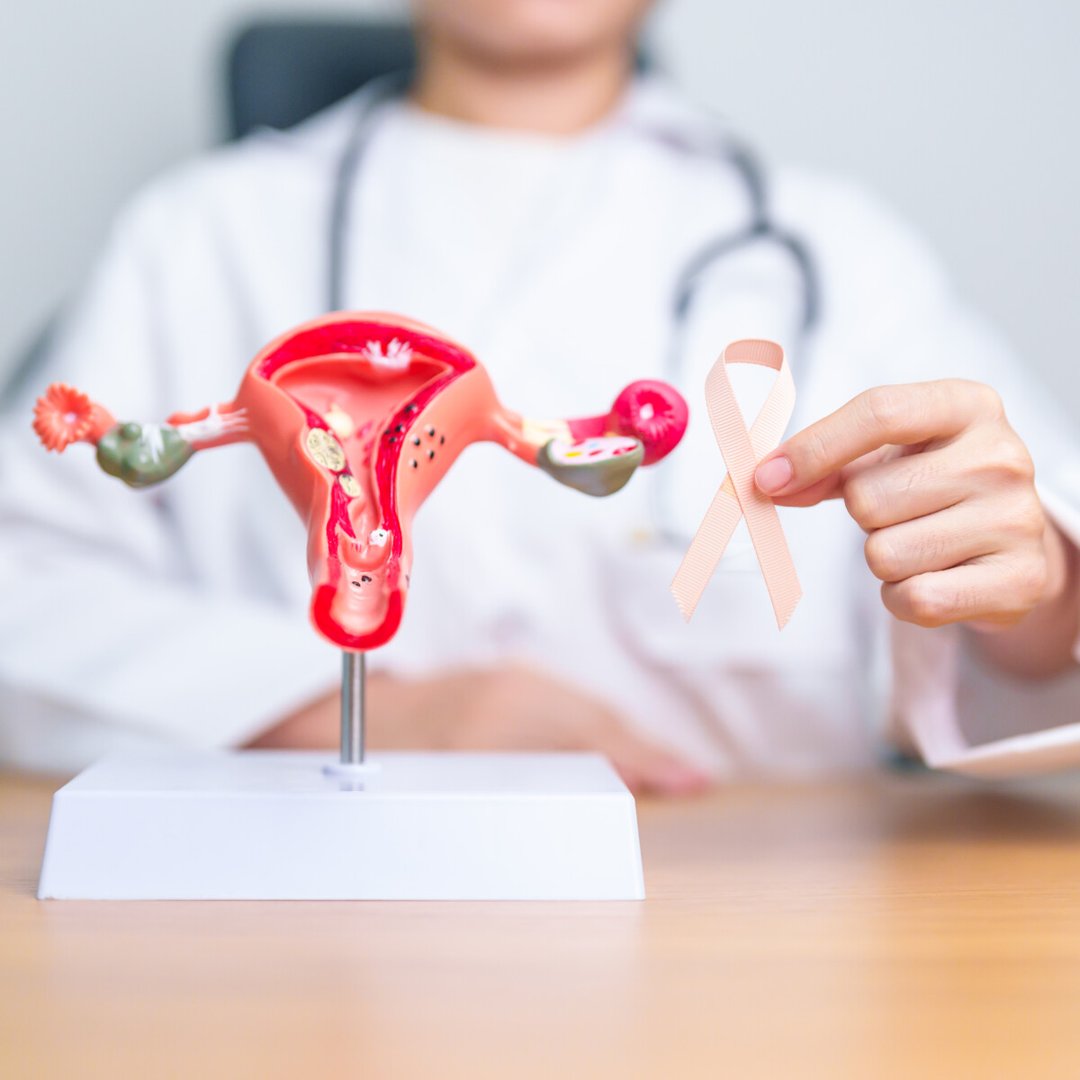 Vulvar Cancer Symptoms