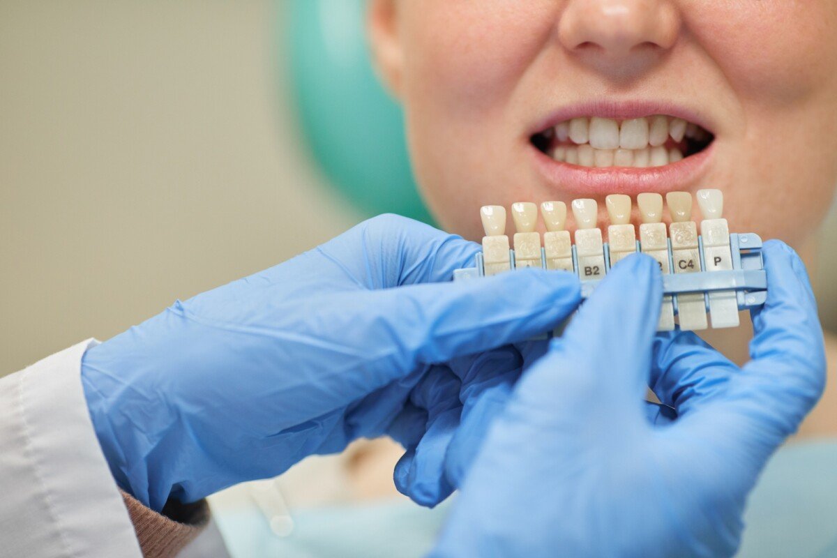 single tooth implant cost with insurance