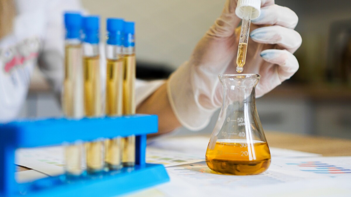 Understanding the Trichomoniasis Urine Test Female for Better Health