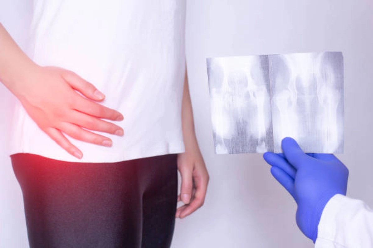What Are Your Legal Options in a Hernia Mesh Case?
